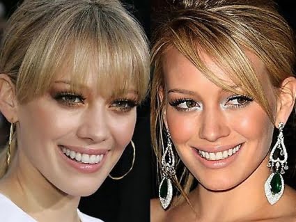 Hillary Duff Chirurgia