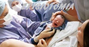 Episiotomia , incisione della vulva durante il travaglio