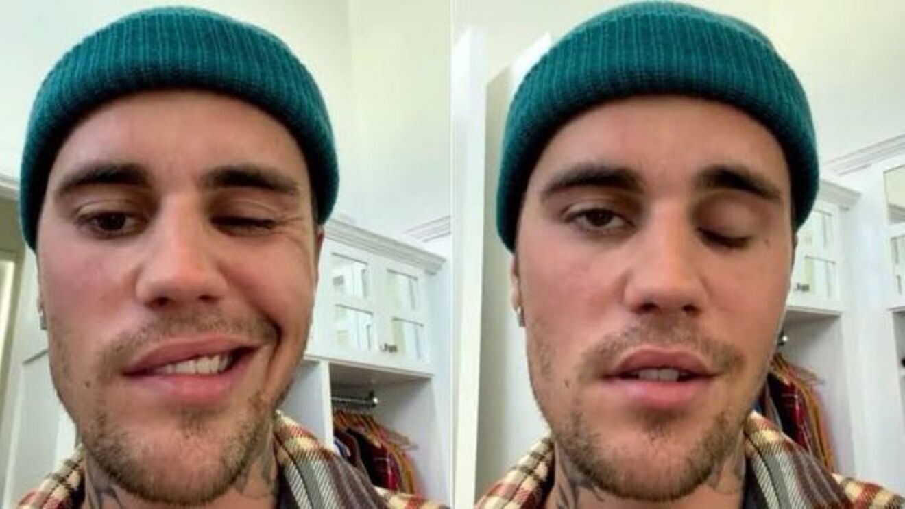 ramsay_hunt_bieber